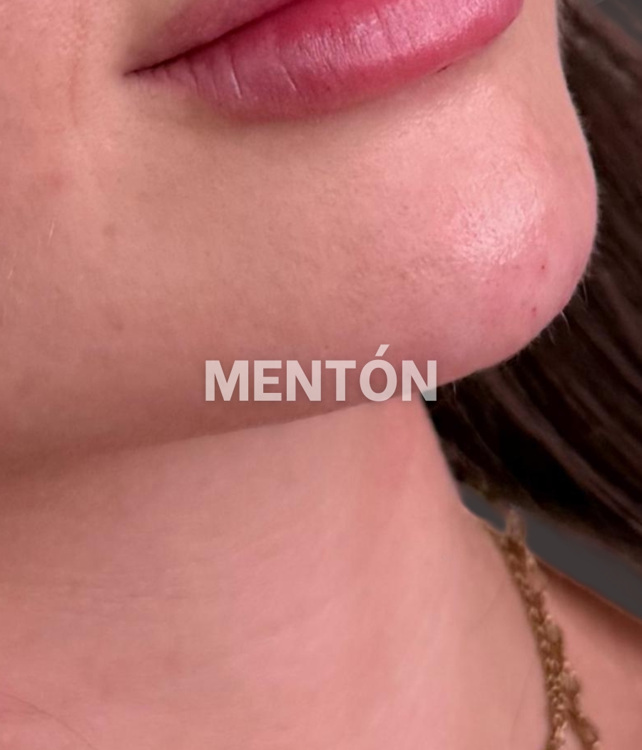 PORTADAS SERVICIOS ABARCAME (6)